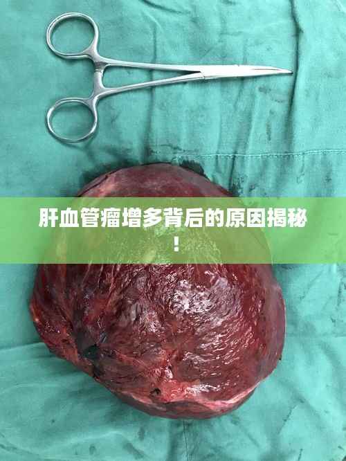 肝血管瘤增多背后的原因揭秘!