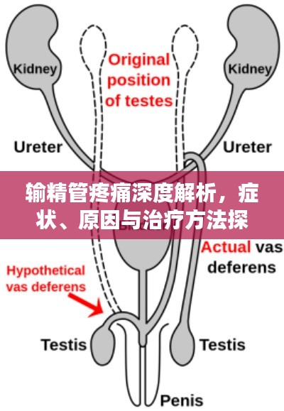 输精管疼痛深度解析,症状、原因与治疗方法探讨